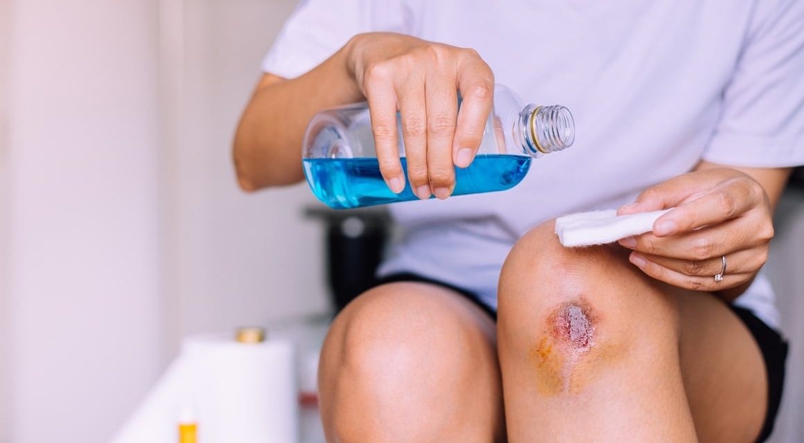 Penggunaan Zat Kimia Sebagai Antiseptik Saat Luka