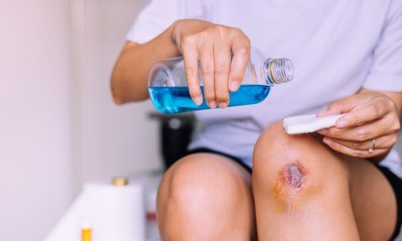 Penggunaan Zat Kimia Sebagai Antiseptik Saat Luka