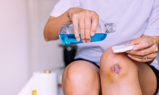 Penggunaan Zat Kimia Sebagai Antiseptik Saat Luka