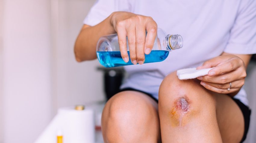 Penggunaan Zat Kimia Sebagai Antiseptik Saat Luka